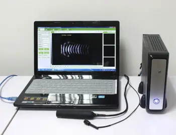 ММ Портативный офтальмологический A/B сканер, Ультразвук глаза Частотой 10 МГц